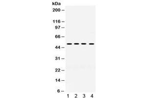 Western blot testing of human 1) HeLa, 2) PANC, 3) HepG2 and 4) A549 cell lysate with KIM1 antibody.