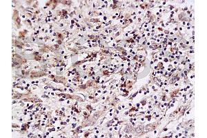 Immunohistochemistry (IHC) image for anti-Placenta Growth Factor (PGF) (AA 166-221) antibody (ABIN727235) (PLGF anticorps  (AA 166-221))