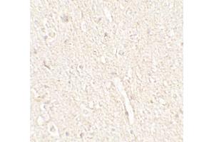 Immunohistochemistry (IHC) image for anti-Energy Homeostasis Associated (ENHO) (C-Term) antibody (ABIN2457882) (ENHO anticorps  (C-Term))