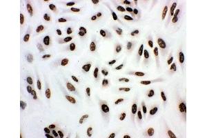 anti-Histone Deacetylase 3 (HDAC3) (AA 411-428) antibody