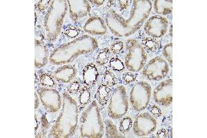 Immunohistochemistry of paraffin-embedded rat kidney using PSAP Rabbit pAb (ABIN3022605, ABIN3022606, ABIN3022607, ABIN1513432 and ABIN6218938) at dilution of 1:100 (40x lens).