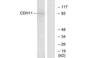 Western Blotting (WB) image for anti-Cadherin 11 (CDH11) (Internal Region) antibody (ABIN1850214) (OB Cadherin anticorps  (Internal Region))