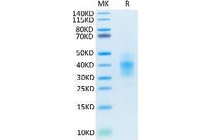 SDS-PAGE (SDS) image for NKG2C & CD94 protein (His-Avi Tag) (ABIN7275330)
