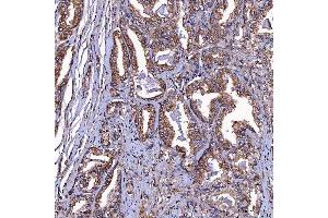 IHC analysis of TOMM34 using anti-TOMM34 antibody (ABIN7599253). (TOMM34 anticorps  (AA 1-309))