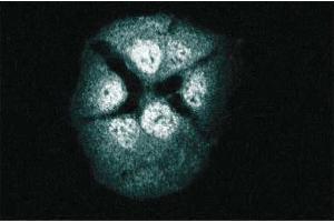 Immunofluorescence staining of A431 cells. (RAP1 anticorps  (AA 1-184))