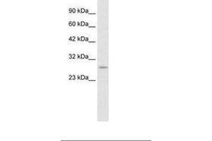 Image no. 2 for anti-Ring Finger Protein 141 (RNF141) (AA 96-145) antibody (ABIN6735889)
