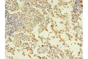 Immunohistochemistry of paraffin-embedded human thymus tissue using ABIN7150034 at dilution of 1:100 (A Disintegrin and Metallopeptidase Domain 1a (ADAM1A) (AA 214-504) anticorps)