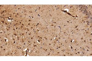 Detection of GFAP in Rat Cerebrum Tissue using Polyclonal Antibody to Glial Fibrillary Acidic Protein (GFAP) (GFAP anticorps  (AA 1-430))