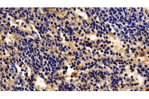 Detection of ACP5 in Rabbit Spleen Tissue using Polyclonal Antibody to Acid Phosphatase 5, Tartrate Resistant (ACP5) (ACP5 anticorps  (AA 74-321))