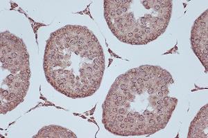 Immunohistochemistry of paraffin-embedded rat testis using RanG Rabbit mAb (ABIN7269846) at dilution of 1:100 (40x lens).