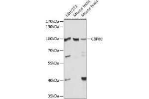 Western blot analysis of extracts of various cell lines, using CBP80 antibody (ABIN6134006, ABIN6138009, ABIN6138010 and ABIN6218117) at 1:1000 dilution. (NCBP1 anticorps)