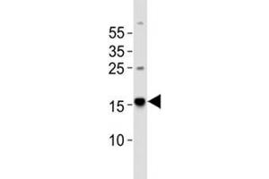 Western blot analysis of lysate from human brain tissue using Map1lc3a antibody diluted at 1:1000. (MAP1LC3A anticorps  (AA 91-123))