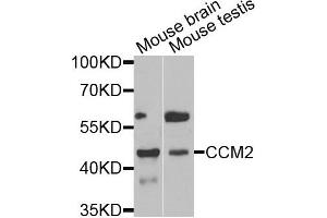 Western blot analysis of extracts of mouse brain and mouse testis tissues, using CCM2 antibody.
