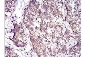 anti-Prolactin (PRL) (AA 65-173) antibody