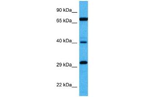 Host:  Mouse  Target Name:  DMTF1  Sample Tissue:  Mouse Kidney  Antibody Dilution:  1ug/ml (DMP1 anticorps  (Middle Region))