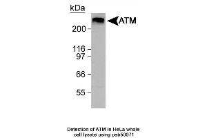 Image no. 1 for anti-Ataxia Telangiectasia Mutated (ATM) (C-Term) antibody (ABIN363380) (ATM anticorps  (C-Term))