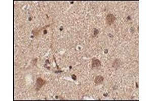 Immunohistochemistry of Slitrk5 in human brain tissue with this product at 2. (SLITRK5 anticorps  (Center))