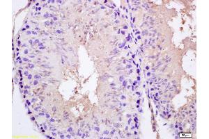 Formalin-fixed and paraffin embedded rat testis labeled with Rabbit Anti SPAG5/MAP126/Astrin Polyclonal Antibody, Unconjugated (ABIN672261) at 1:200 followed by conjugation to the secondary antibody and DAB staining (SPAG5 anticorps  (AA 1101-1193))