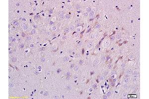 Formalin-fixed and paraffin embedded rat brain labeled with Anti-ErbB-3/HER3 Polyclonal Antibody, Unconjugated (ABIN686767) at 1:200 followed by conjugation to the secondary antibody and DAB staining.