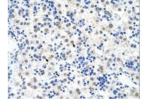Image no. 1 for anti-DEAD (Asp-Glu-Ala-Asp) Box Polypeptide 47 (DDX47) (C-Term) antibody (ABIN203146)