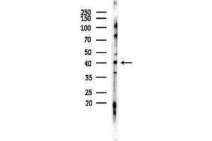 anti-Calcium Binding Protein 1 (CABP1) (Internal Region) antibody