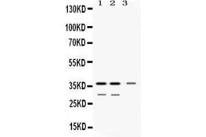 Western blot analysis of DDAH1 expression in rat kidney extract ( Lane 1), mouse kidney extract ( Lane 2) and HELA whole cell lysates ( Lane 3). (DDAH1 anticorps  (C-Term))