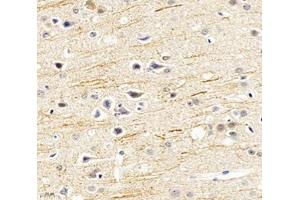 Immunohistochemistry analysis of paraffin-embedded mouse hippocampus using SCN8A (ABIN7075647) at dilution of 1: 1200