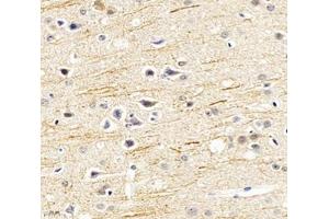Immunohistochemistry analysis of paraffin-embedded mouse hippocampus using SCN8A (ABIN7075647) at dilution of 1: 1200 (SCN8A anticorps)