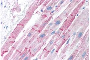 Human Heart (formalin-fixed, paraffin-embedded) stained with ESR2 antibody ABIN214750 at 5 ug/ml followed by biotinylated goat anti-rabbit IgG secondary antibody ABIN481713, alkaline phosphatase-streptavidin and chromogen.