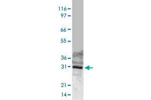 Western blot analysis of full-length, recombinant human BIRC7 using BIRC7 polyclonal antibody  at 1 : 2000. (BIRC7 anticorps)