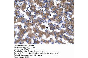 Rabbit Anti-VDAC1 Antibody  Paraffin Embedded Tissue: Human Liver Cellular Data: Hepatocytes Antibody Concentration: 4. (VDAC1 anticorps  (C-Term))