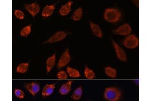Immunofluorescence analysis of L929 cells using HPS4 Polyclonal Antibody at dilution of 1:100.