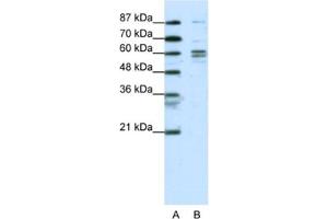 Western Blotting (WB) image for anti-General Transcription Factor IIF, Polypeptide 1, 74kDa (GTF2F1) antibody (ABIN2463819) (GTF2F1 anticorps)