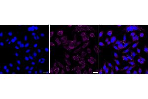 Immunocytochemical staining of HepG2 cells with Melanocortin 5 receptor antibody (ABIN7799355), 1:1,000). (Recombinant MC5 Receptor anticorps)