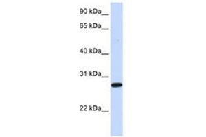 Image no. 1 for anti-Deoxycytidine Kinase (DCK) (AA 180-229) antibody (ABIN6741110) (DCK anticorps  (AA 180-229))