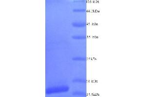SIVA1, Apoptosis-Inducing Factor (SIVA1) (AA 1-110), (Isoform 2) protein (His tag)