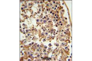 FANCC Antibody IHC analysis in formalin fixed and paraffin embedded testis tissue followed by peroxidase conjugation of the secondary antibody and DAB staining. (FANCC anticorps  (C-Term))