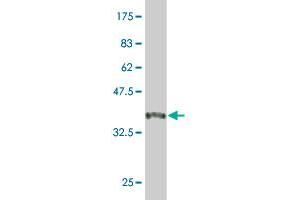 Western Blot detection against Immunogen (44 KDa) .