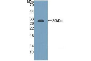 Western blot analysis of recombinant Rat CA2.