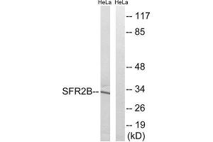 Western Blotting (WB) image for anti-serine/arginine-Rich Splicing Factor 8 (SRSF8) (Internal Region) antibody (ABIN1852230) (SFRS2B anticorps  (Internal Region))