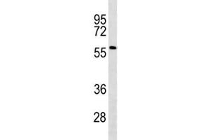 ACSF2 antibody western blot analysis in human Jurkat lysate. (ACSF2 anticorps  (AA 587-615))