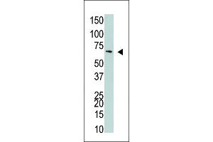 The anti-NYREN18 Pab (ABIN389079 and ABIN2839277) is used in Western blot to detect NYREN18 in 293 cell lysate.