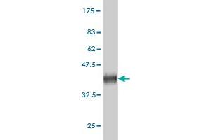 Western Blot detection against Immunogen (37. (DPH2 anticorps  (AA 125-235))