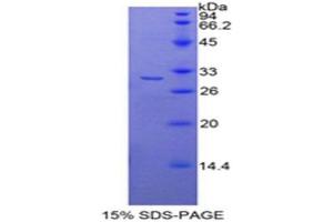 SDS-PAGE analysis of Mouse Histone Deacetylase 6 Protein. (HDAC6 Protéine)