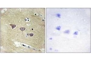 Immunohistochemistry analysis of paraffin-embedded human brain tissue, using CAMK5 Antibody.