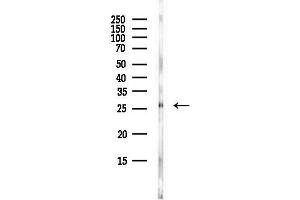 Western blot analysis of lysates from EC304 cells(heat-shock,45 min treatment), using TGF beta induced factor 2 Antibody at 1/1000 dilution.