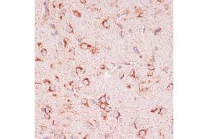 Immunohistochemistry of paraffin-embedded rat brain using ENTPD6 antibody (ABIN7266897) at dilution of 1:100 (40x lens). (ENTPD6 anticorps  (AA 61-300))