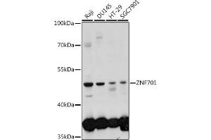 Western blot analysis of extracts of various cell lines, using ZNF701 antibody (ABIN7271523) at 1:1000 dilution. (ZNF701 anticorps  (AA 100-200))