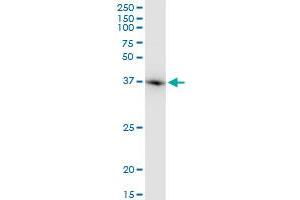 ACTB monoclonal antibody (M03), clone 1E7. (beta Actin anticorps  (AA 1-375))