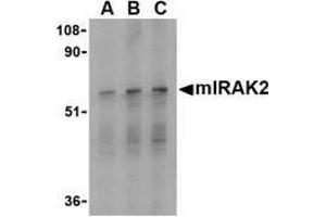 Western blot analysis of IRAK2 in RAW264. (IRAK2 anticorps  (C-Term))